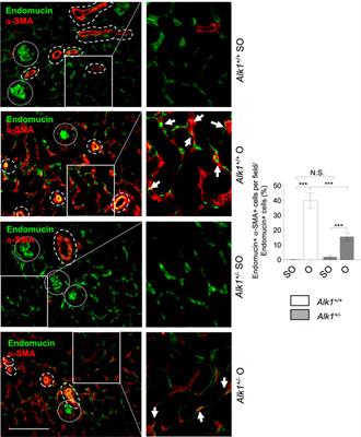 Endothelial Activin Receptor-Like Kinase 1 (ALK1) Regulates Myofibroblast Emergence and Peritubular Capillary Stability in the Early Stages of Kidney Fibrosis